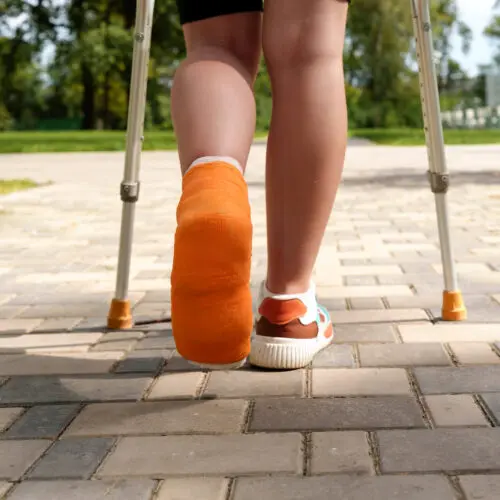 close up shot of two legs walking with crutches and the left foot in an orange cast